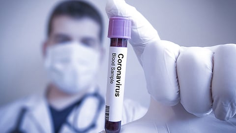 فلسطين.. ارتفاع عدد مصابي كورونا إلى 117