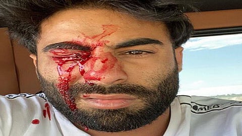 اعتداء على نجم السوشيال ميديا «عبودكا» لسبب غريب