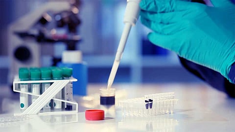 إصابات كورونا في ألمانيا تتجاوز 139 ألفًا.. والوفيات تصل إلى 4249 حالة