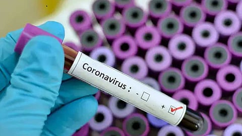 بعد شهرين.. ظهور نتائج تجربة عقار الملاريا في مكافحة فيروس كورونا