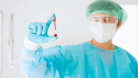 فيروس كورونا.. ارتفاع الإصابات في أفغانستان إلى 7653 حالة