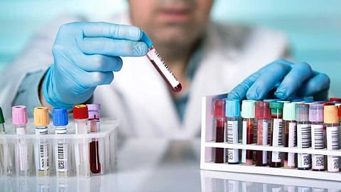 عالم بريطاني: فيروس كورونا خارج السيطرة.. اللقاح ليس حلًّا