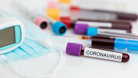 إصابات كورونا الجديدة: 34% سعوديون.. و66% وافدون