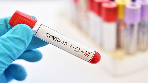 بـ742 حالة مؤكدة.. الرياض تتصدر إصابات كورونا الجديدة