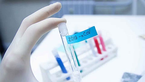 النمر يُبشِّر المصابين بكورونا من مرضى ضغط الدم بإمكانية الشفاء