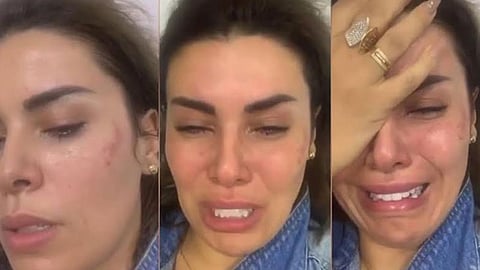 بالفيديو.. أماني السويسي تتعرض للضرب المبرح من متعهد حفلات