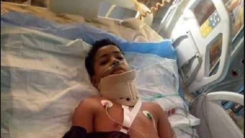 ألقوه في الفرن وأشعلوا النيران ووضعوه في العجان فأصابوه بالشلل.. حكاية طفل أسوان الناجي من الموت بأعجوبة