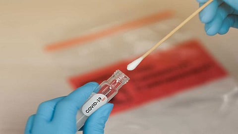 بالأرقام.. خريطة الإصابات بفيروس كورونا في المملكة