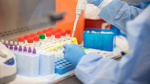 «بأسرع ما يمكن».. وثيقة أمريكية تُحدِّد استراتيجية تقديم لقاح كورونا