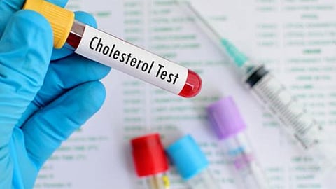 ما هي الفترة العمرية التي تستوجب فحص الكوليسترول لدى المرأة؟.. خبراء يجيبون