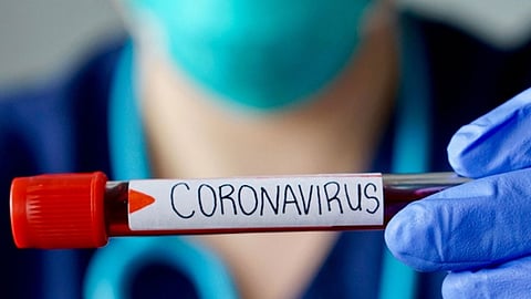 استشاري أمراض معدية يحسم «احتمالية عودة فيروس كورونا للمتعافين»