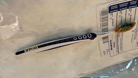 عشرينية تبتلع فرشاة أسنان بالخطأ.. وفريق النور الطبي بمكة يتدخَّل