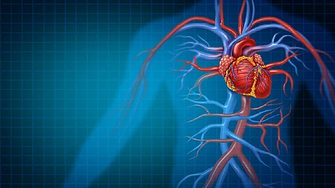 النمر: دعامات الشرايين آمنة للأشعة المغناطيسية