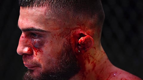 بالفيديو.. لكمة تشطر أذن مقاتل إلى نصفين في بطولة «UFC»
