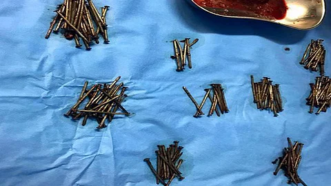 بالفيديو.. «الشعيبي» يفسر حالة بالع المسامير وقطع الزجاج بجدة