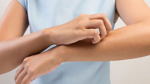 الحساسية تجاه بعض الأطعمة.. «الصحة» توجه نصائح