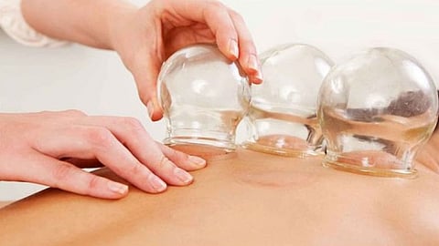 النمر يحذر من إجراء الحجامة أثناء استخدام أحد أدوية سيولة الدم