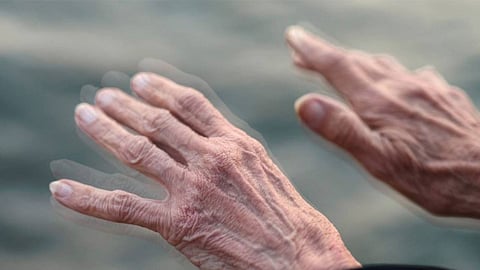 الرعاش.. إليك الأسباب والأعراض وطرق العلاج