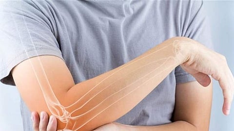 مختصون: «معركتنا صعبة» مع مرض هشاشة العظام بالمملكة.. وخطة وطنية للوقاية