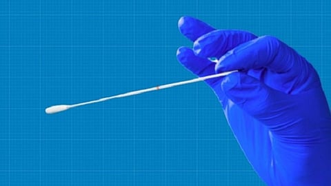 «مسحات شرجية» لكشف إصابات كورونا.. وطبيب صيني: أكثر فاعلية