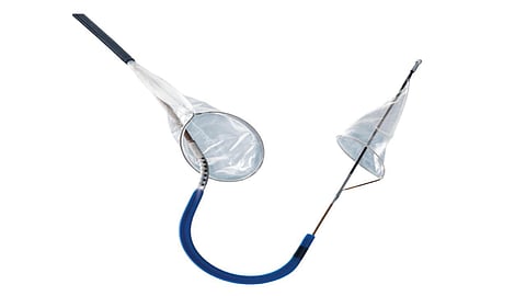 لأول مرة.. تركيب صمام لمريض باستخدام جهاز الحماية من التجلطات الدماغية