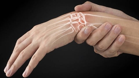 نقص الكالسيوم.. أسبابه وأعراضه وطرق العلاج