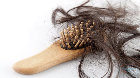 6 أطعمة تتسبب في تساقط الشعر