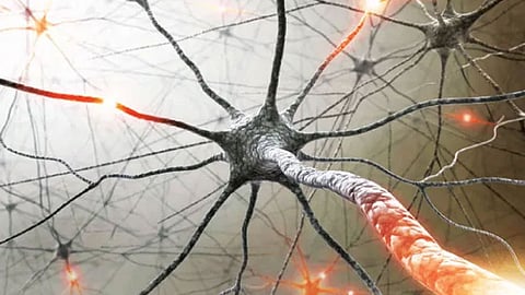 التصلب العصبي المتعدد.. أعراضه وعلاجه وتمارين للحفاظ على العضلات