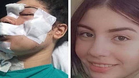 سيدة مصرية تتصالح مع زوجها بعد أن طعنها بسكين