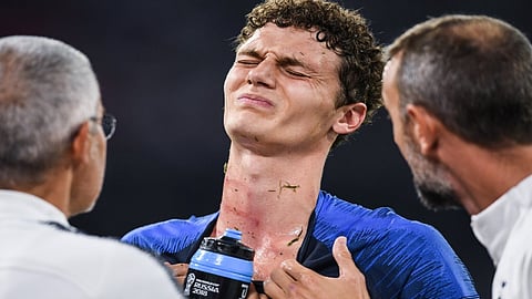 «يورو 2020».. تساؤلات حول سلامة اللاعبين بعد إصابة بافارد