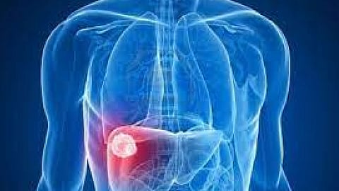 دراسة: المكملات الغذائية خطر على الكبد