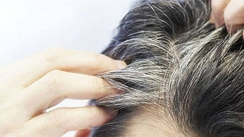 9 أطعمة تساعد على الوقاية من الشعر الأبيض