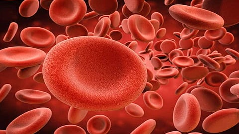 طبيب قلب: 10 علامات تدلّ على الإصابة بفقر الدم