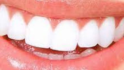 دراسة: مبيضات الأسنان تسبب 3 أخطار