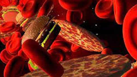 علماء يحددون علامات ارتفاع الكوليسترول بالدم.. ويوجهون نصيحة