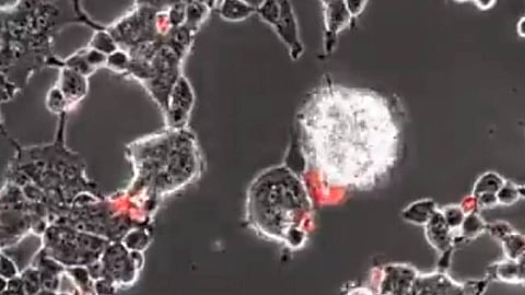 فيديو يرصد كيف يغزو فيروس كورونا خلايا الدماغ