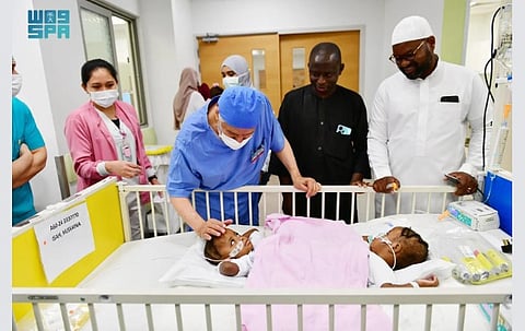 Saudi Medical Team Begins Separating Nigerian Conjoined Twins Hassana and Hasina