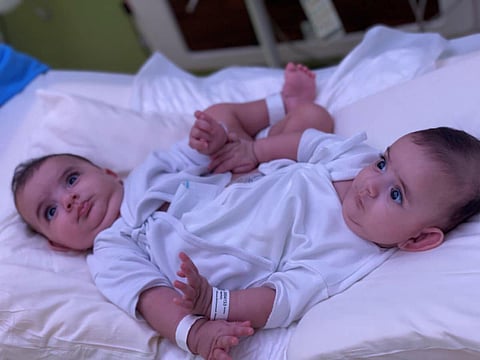 Libyan Siamese twins