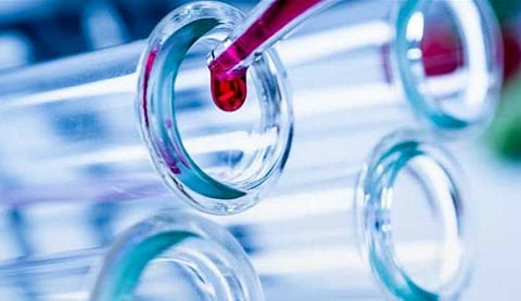 Schools shut, travel curbed as world races to fight coronavirus