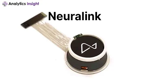 Neuralink's Blindsight Chip: First Human Implant Scheduled for 2025