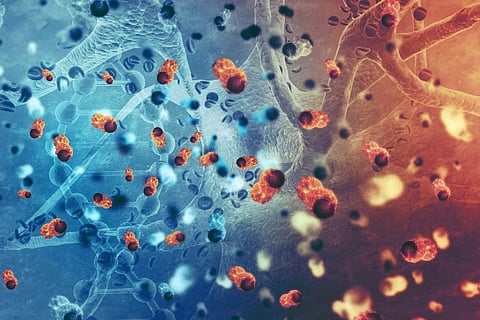 AI Detects Cancer Faster than Humans
