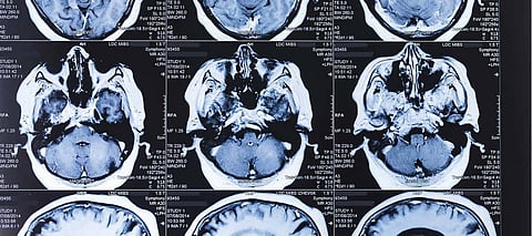 Artificial Intelligence is on a Par with Human Experts in Medical Diagnoses