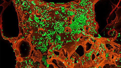 How Robots are Being Deployed to Fight Coronavirus Outbreak?