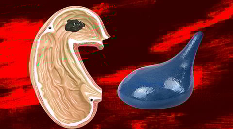 Slime Magnet Robot: Saving Lives by Grabbing Accidentally Swallowed Objects