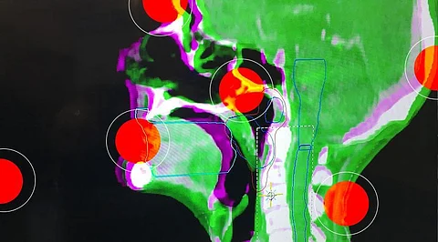 AI Tool Can Save You from Cancer! It will Just Take Two Seconds