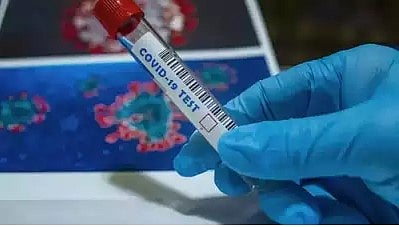 கொரோனாவுக்கு இரண்டாவதாக ஆண் ஒருவர் பலி!