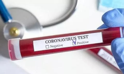 ক'ৰ'না বিভীষিকা : নগালেণ্ডত ক'ৱিড-১৯ আক্ৰান্তৰ সংখ্যা ৩৬ লৈ বৃদ্ধি