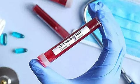 পৰিস্থিতি উদ্বেগজনকঃ নগালেণ্ডত ১২৭লৈ বৃদ্ধি ক'ৰ'না আক্ৰান্ত