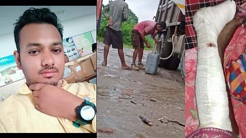 দেৰগাঁৱত তেল মাফিয়াৰ আক্ৰমণত গুৰুতৰভাবে আহত পিতা-পুত্ৰ