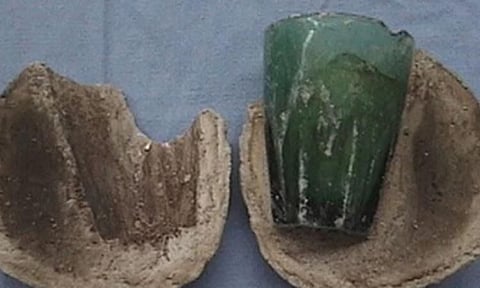 মহিলাৰ 'গুপ্তাংগ'ৰ পৰা ওলাল এটা আইনাৰ গিলাচ  ; ৪ বছৰ ধৰি সোমাই আছিল গিলাচটো, হতভম্ব চিকিৎসকো